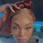 Onlyfans leak kissedxkd 

 profile picture